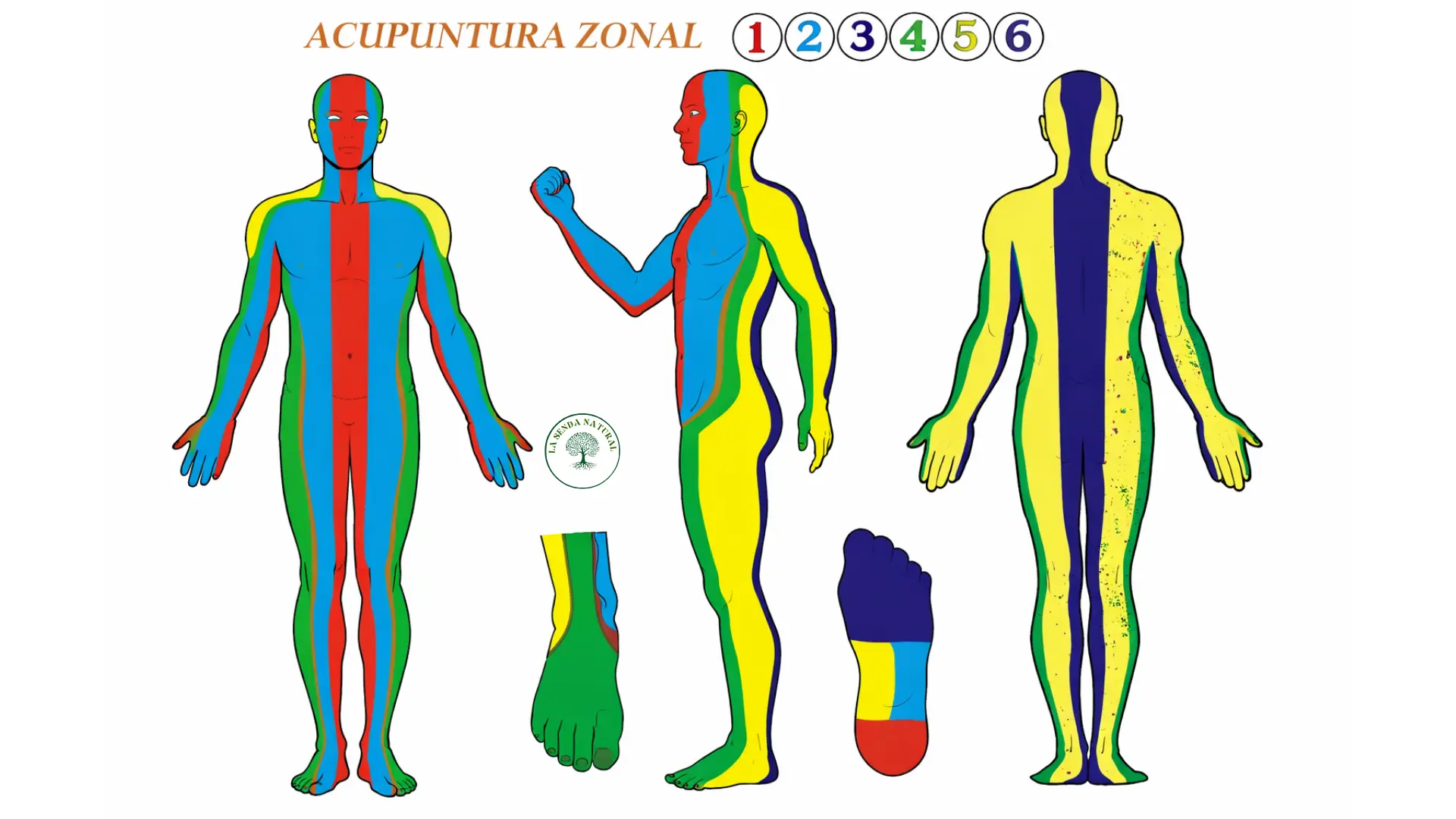 Acupuntura zonal