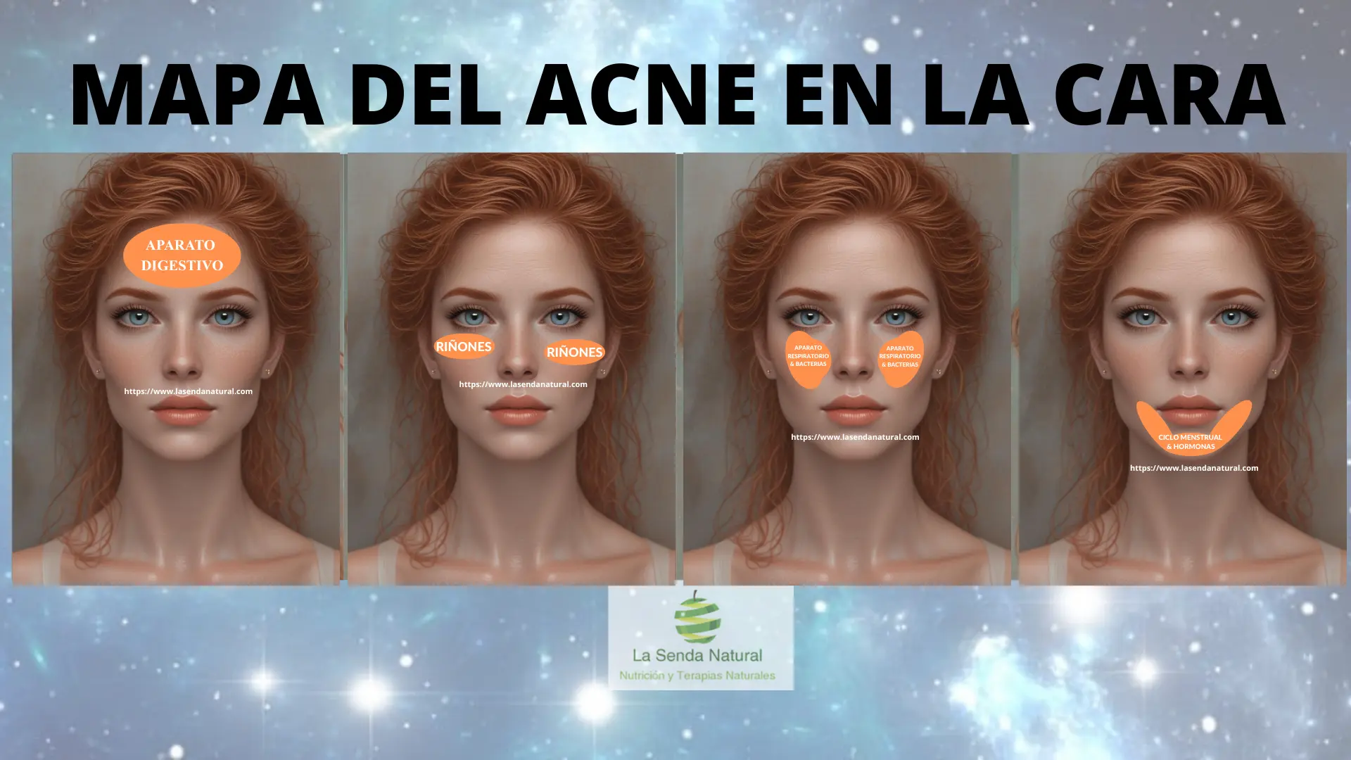 MAPA DEL ACNE EN LA CARA