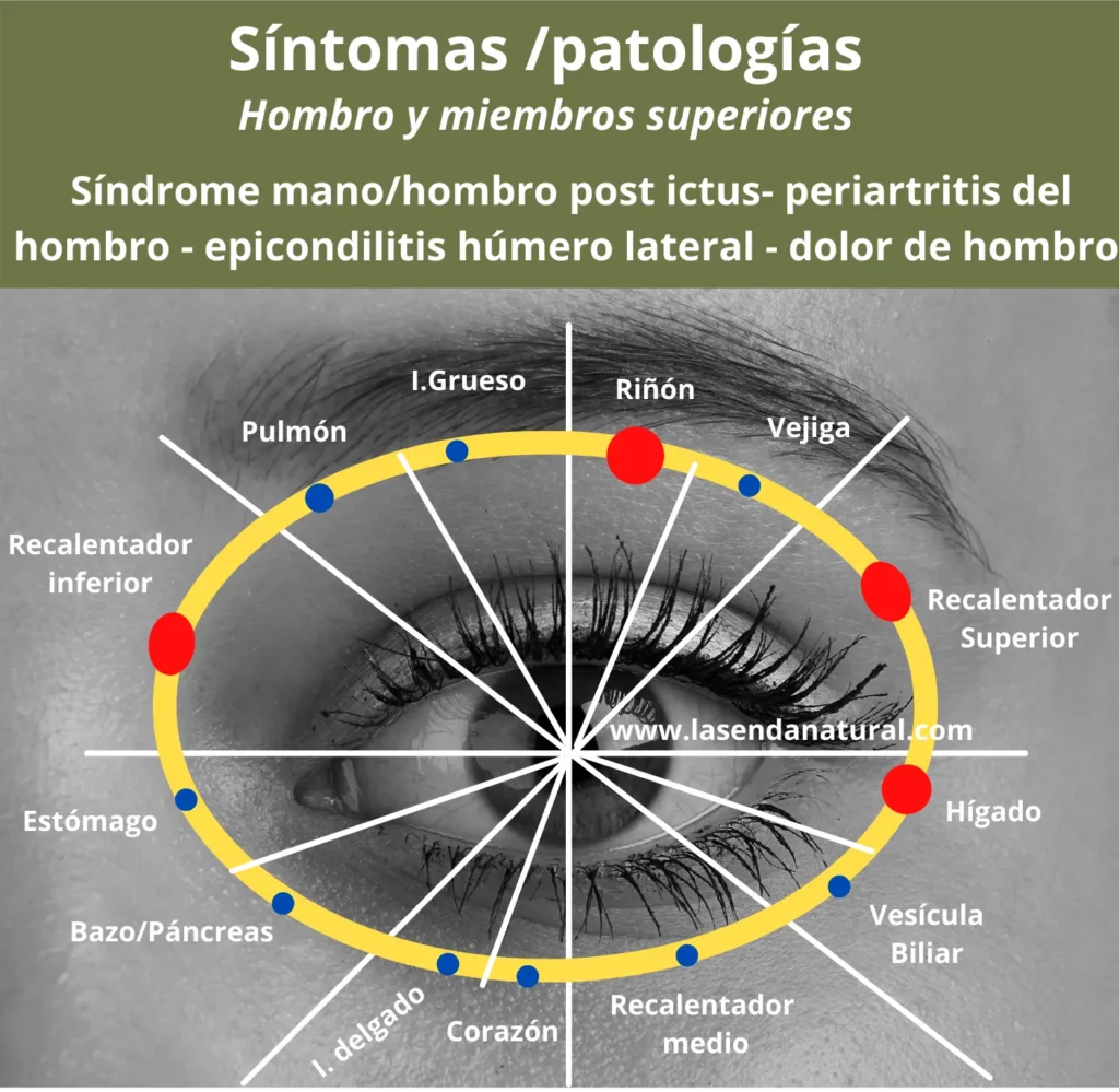 Acupuntura ocular para el hombro y extremidades superiores