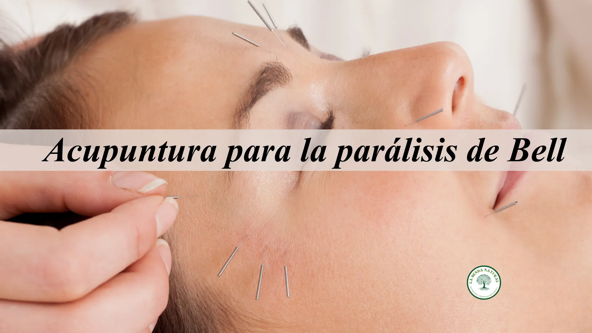 Acupuntura para la parálisis de Bell