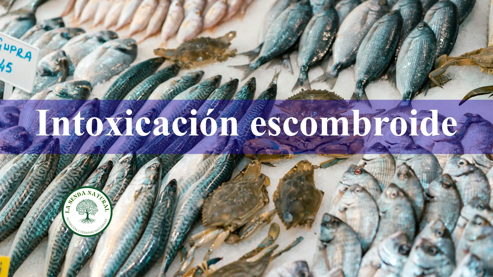 Intoxicación escombroide