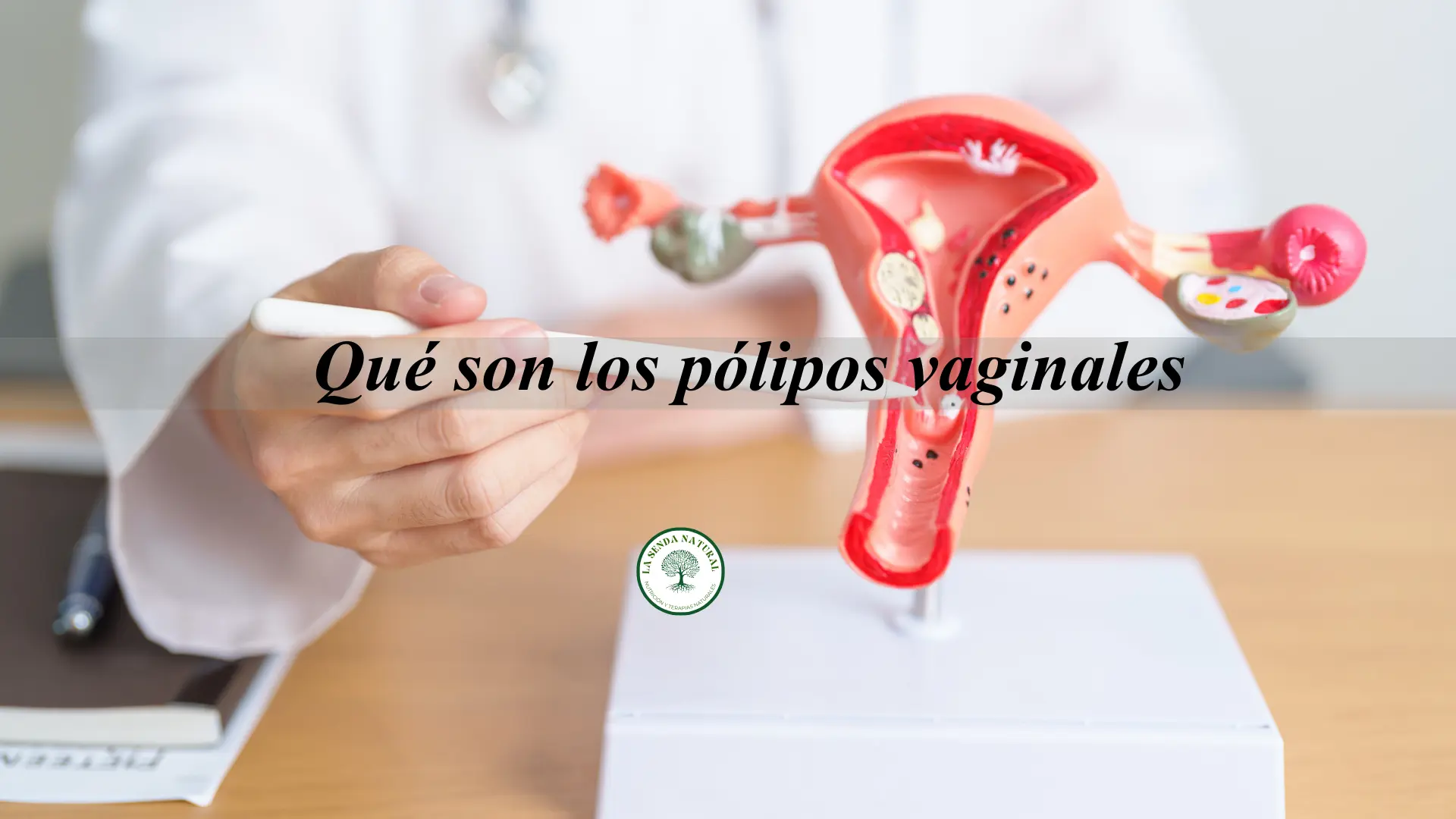 Pólipos vaginales
