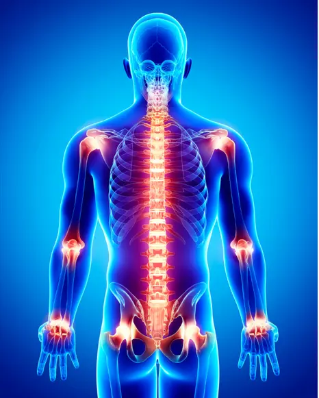 acupuntura para el dolor