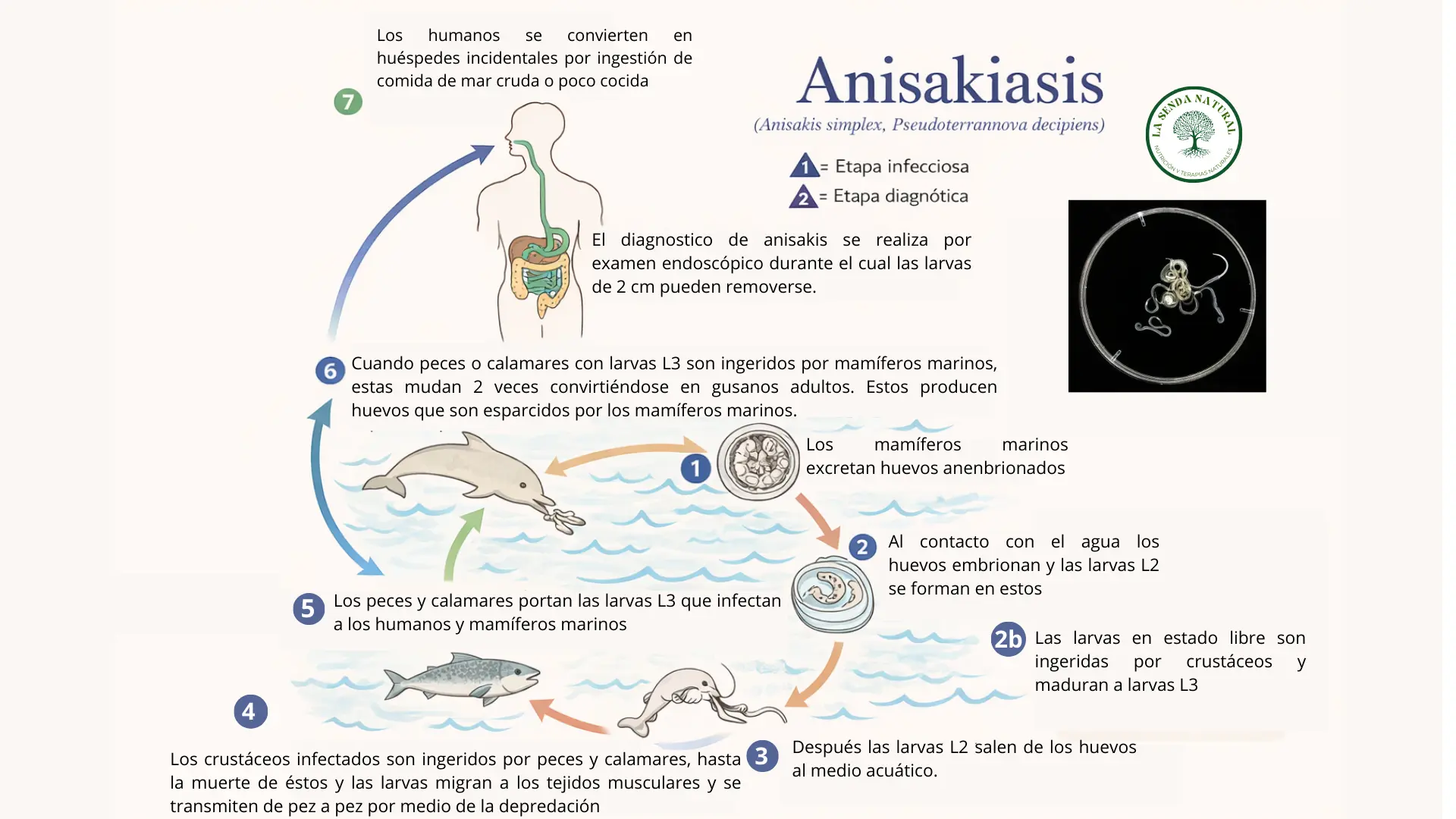 Ciclo del anasakis