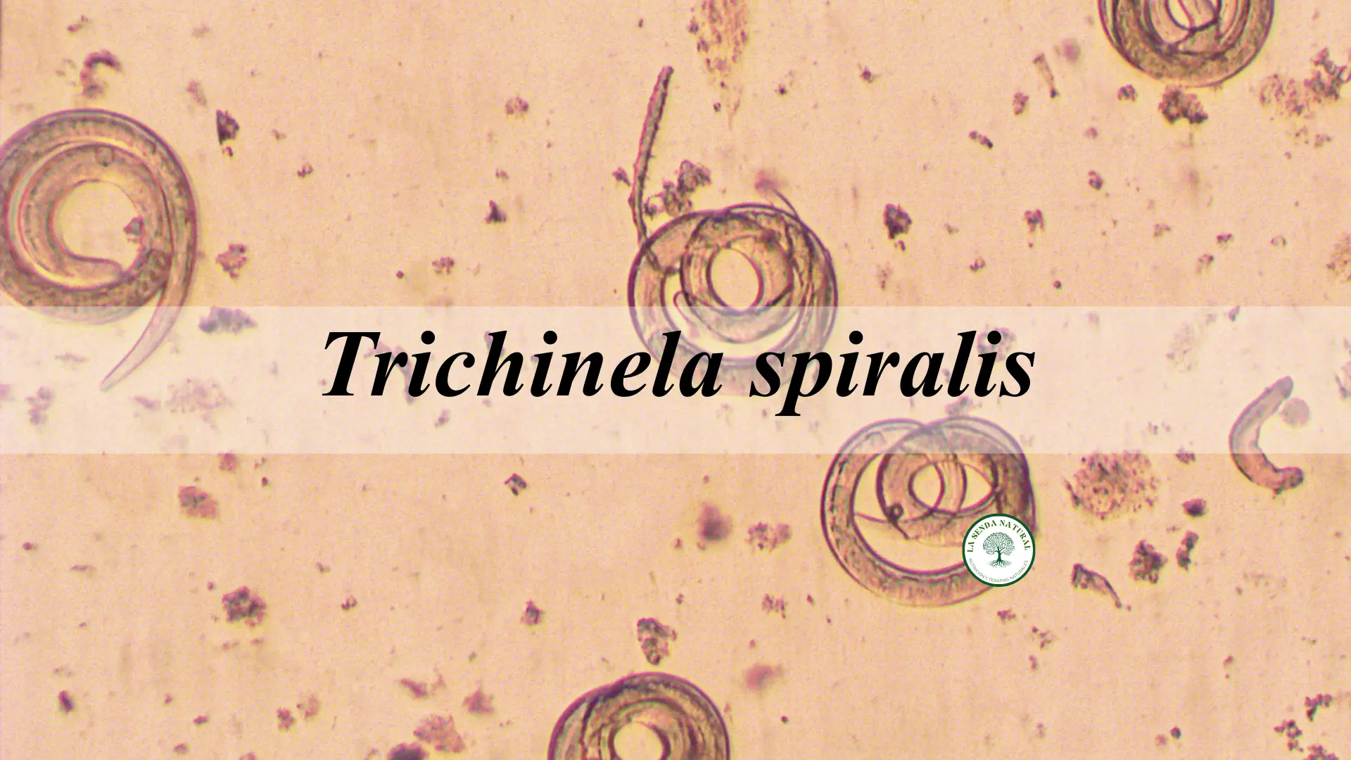 Trichinella spiralis