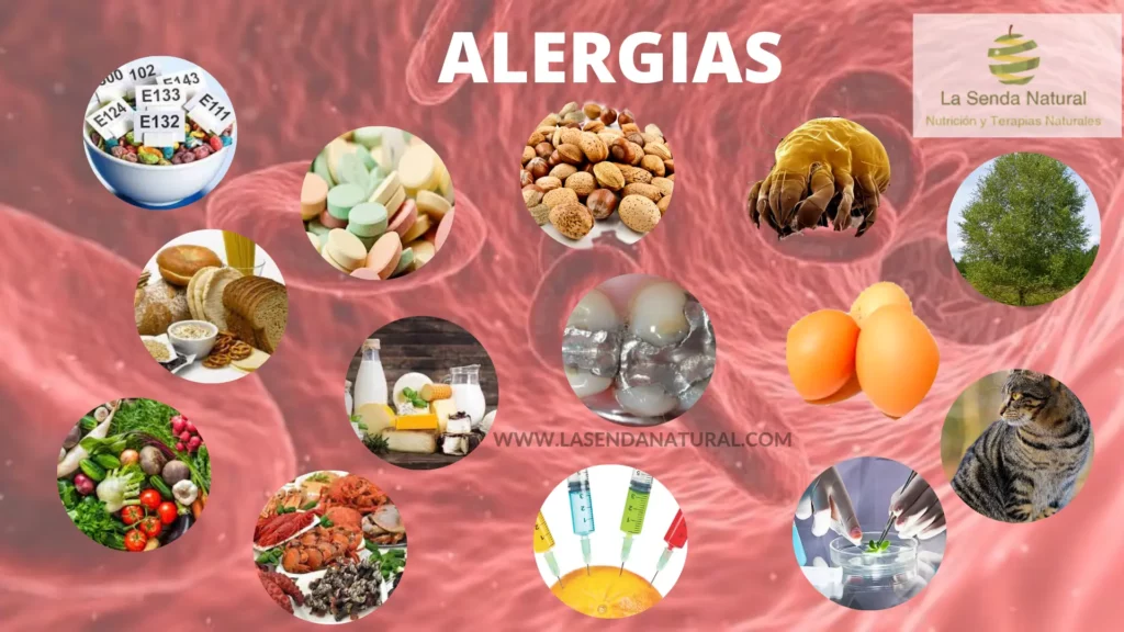 Qué son las alergias