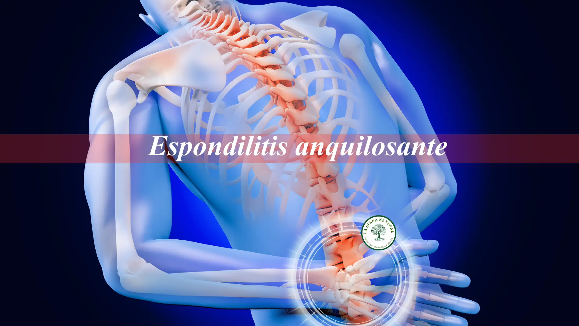 Qué es la Espondilitis anquilosante