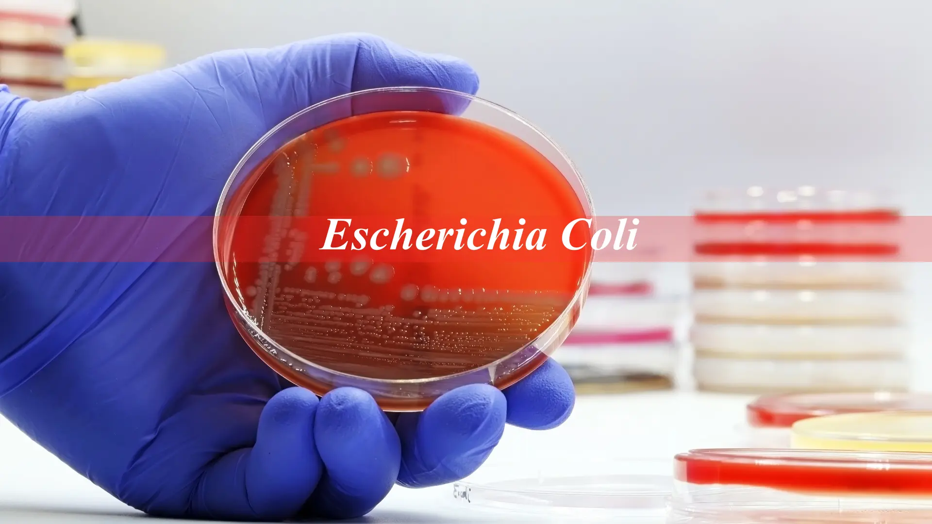 Infección por escherichia coli