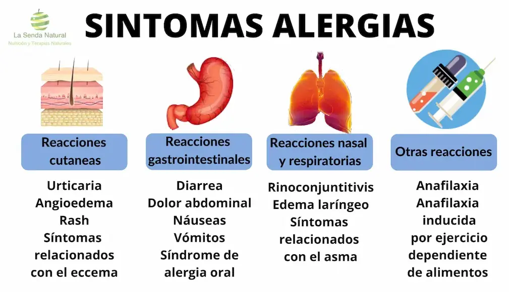 Síntomas alergias