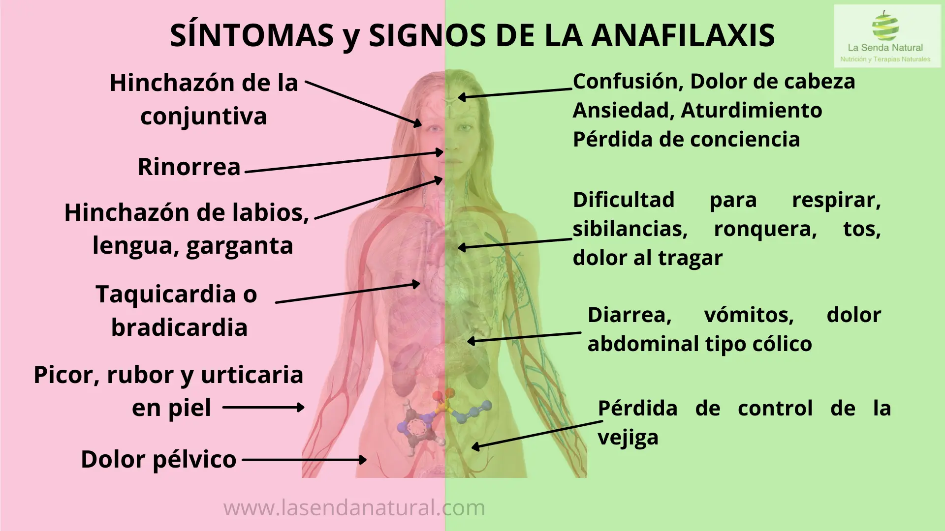 anafilaxis