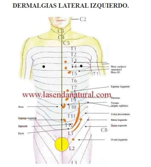 dermalgias izquierdas